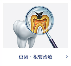 虫歯・根管治療