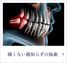 痛くない親知らずの抜歯
