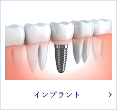 インプラント