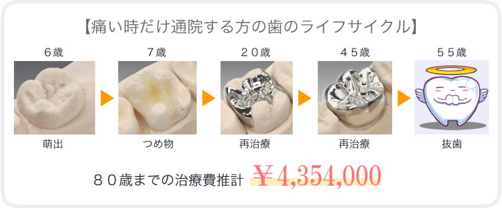 予防を習慣にしている人の生涯治療費と歯の寿命
